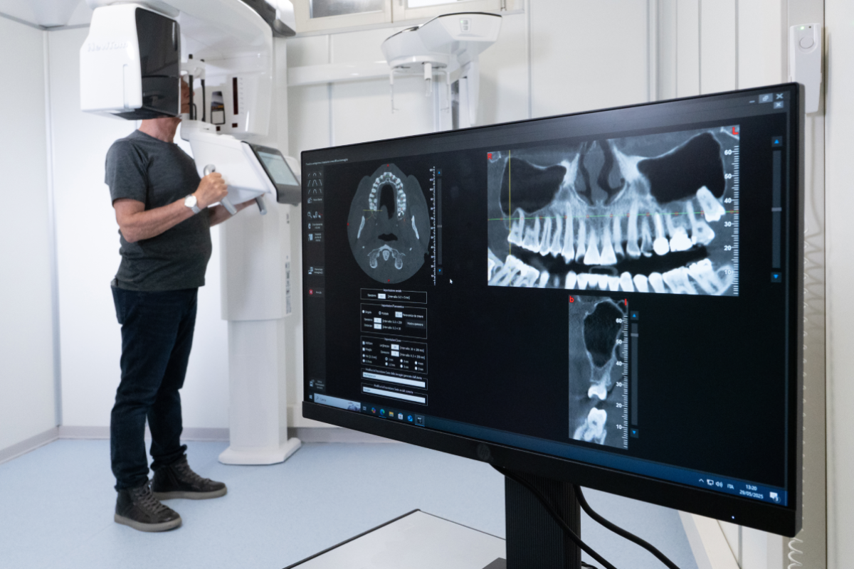 Igiene Orale ed Implantologia